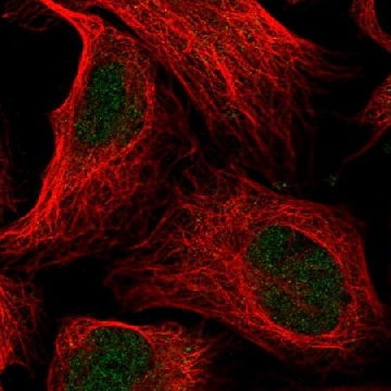 Anti-ANKRD11 antibody produced in rabbit，100UL，HPA041593-100UL，Sigma
