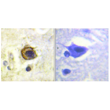 Anti-PDGFR β antibody produced in rabbit，100UG，SAB4502148-100UG，Sigma