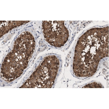 Anti-HSP90 alpha Antibody, clone 4M13 ZooMAb® Rabbit Monoclonal，25UL，ZRB1502-25UL，Sigma