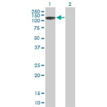 Anti-ZNF526 antibody produced in mouse，50UG，SAB1401964-50UG，Sigma
