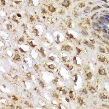 Anti-SGK1 antibody produced in rabbit，100UL，SAB5700669-100UL，Sigma