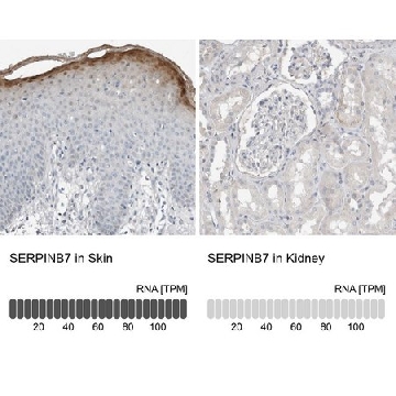 抗-SERPINB7 兔抗，100UL，HPA024200-100UL，Sigma