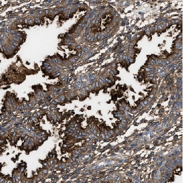 Anti-NT5E antibody produced in rabbit，100UL，HPA017357-100UL，Sigma