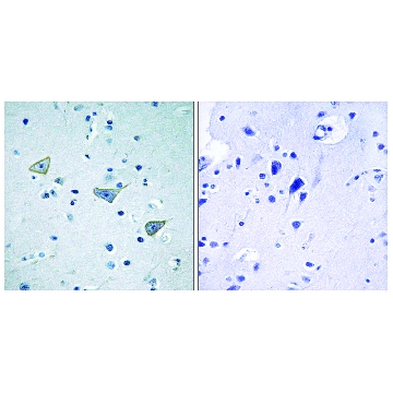 Anti-GPR158 antibody produced in rabbit，100UG，SAB4502509-100UG，Sigma