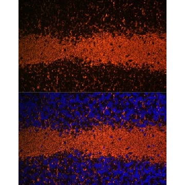 Anti-Myelin Basic Protein antibody produced in rabbit，100UL，SAB5700924-100UL，Sigma