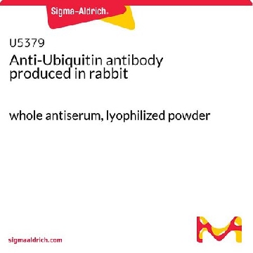 抗  泛素 兔抗，1VIAL，U5379-1VL，Sigma