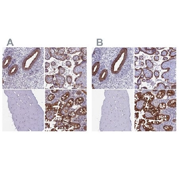 Anti-MYO5B antibody produced in rabbit，100UL，HPA040902-100UL，Sigma