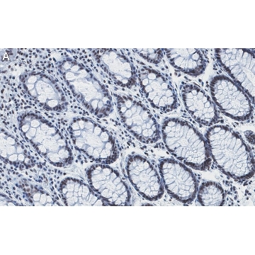 Anti-RAD21 Antibody, clone 2H12 ZooMAb® Rabbit Monoclonal，25UL，ZRB1458-25UL，Sigma