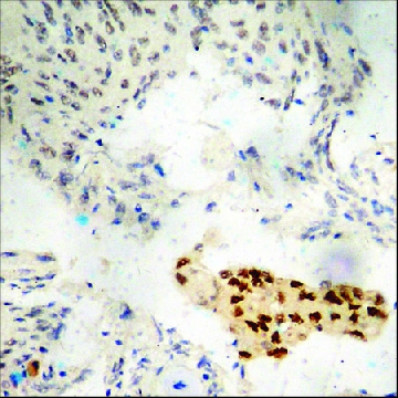Anti-phospho-Estrogen Receptor-α (pSer¹¹⁸) antibody produced in rabbit，100UG，SAB4504399-100UG，Sigma