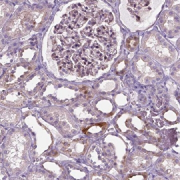 Anti-SPECC1L antibody produced in rabbit，100UL，HPA070614-100UL，Sigma