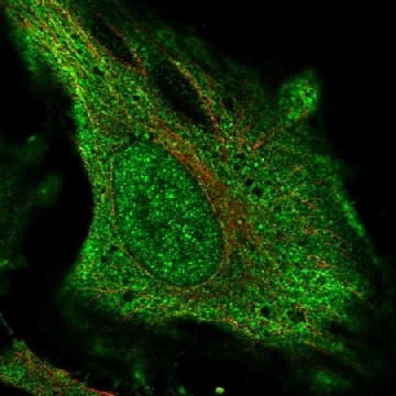 Anti-DNAH17 antibody produced in rabbit，100UL，HPA024354-100UL，Sigma