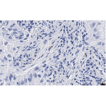 Anti-uPAR Antibody, clone 2G10 , ZooMAb® Rabbit Monoclonal，25UL，ZRB1224-25UL，Sigma
