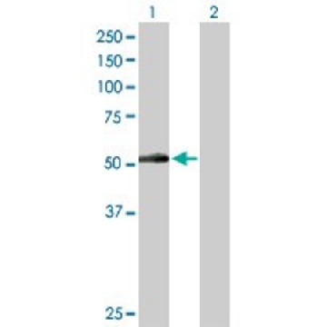 Anti-PNPLA3 antibody produced in rabbit，100UG，SAB1401851-100UG，Sigma