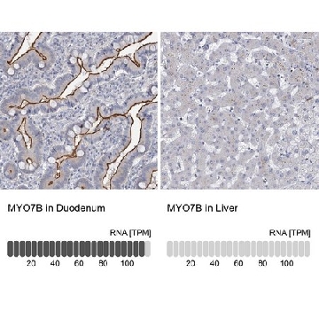 Anti-MYO7B antibody produced in rabbit，100UL，HPA039131-100UL，Sigma