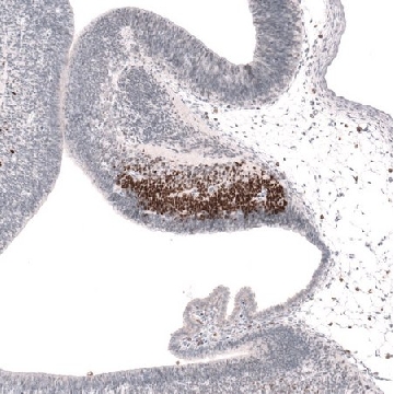 Anti-SKOR2 antibody produced in rabbit，100UL，HPA046206-100UL，Sigma