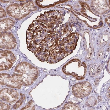 Anti-CYYR1 antibody produced in rabbit，100UL，HPA067685-100UL，Sigma