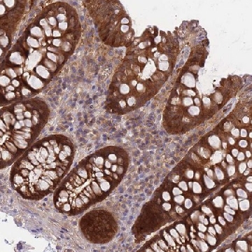 Anti-PREP antibody produced in rabbit，100UL，HPA031389-100UL，Sigma