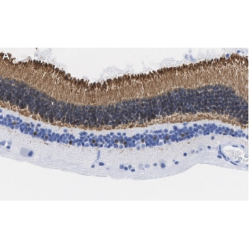 Anti-Recoverin Antibody, clone 1K10 ZooMAb® Rabbit Monoclonal，25UL，ZRB1448-25UL，Sigma