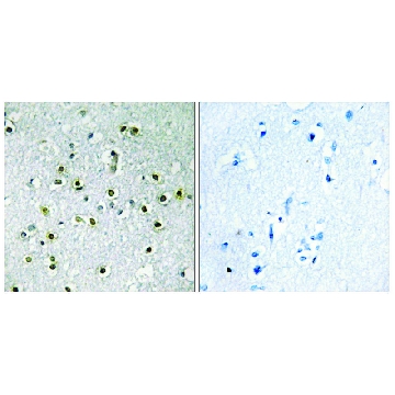 Anti-TFE3 antibody produced in rabbit，100UG，SAB4502952-100UG，Sigma