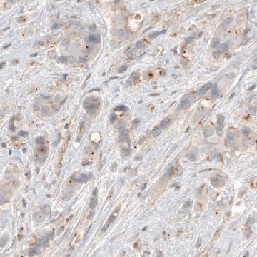 Monoclonal Anti-CDK5RAP2 antibody produced in mouse，100UL，AMAB91163-100UL，Sigma