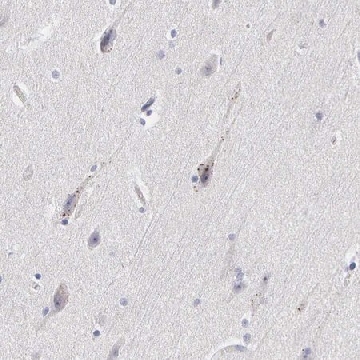 抗-ELFN2 兔抗，100UL，HPA000781-100UL，Sigma