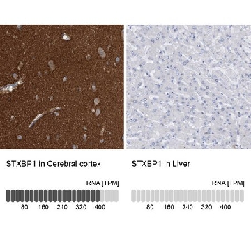 Anti-STXBP1 antibody produced in rabbit，100UL，HPA023483-100UL，Sigma