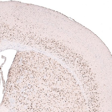 Monoclonal Anti-FOXP2 antibody produced in mouse，100UL，AMAB91361-100UL，Sigma