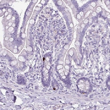 Anti-GLP2R antibody produced in rabbit，100UL，HPA049244-100UL，Sigma