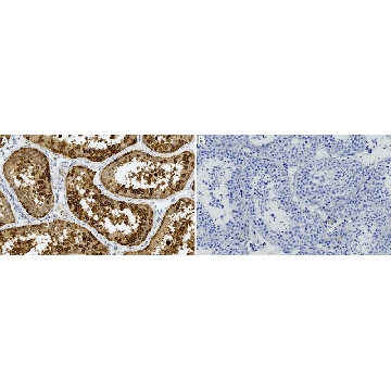 Anti-YB1 Antibody, clone 1G7 ZooMAb® Rabbit Monoclonal，254G，ZRB2841-25UL，Sigma