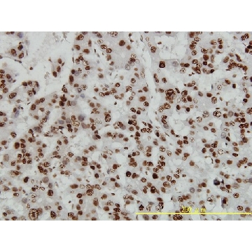 单克隆抗-HMGB1 小鼠抗，100UG，SAB1403925-100UG，Sigma