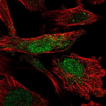 Anti-SLF2 antibody produced in rabbit，100UL，HPA057568-100UL，Sigma
