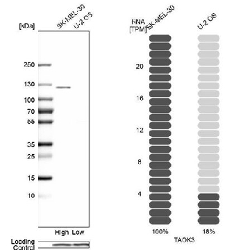Anti-TAOK3 antibody produced in rabbit，100UL，HPA017160-100UL，Sigma