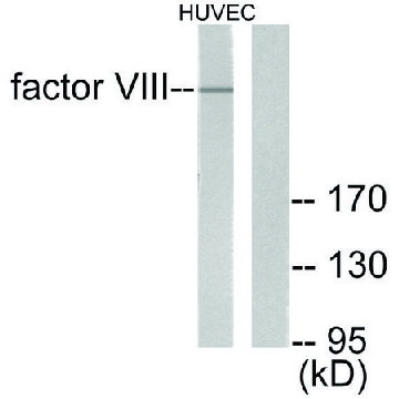 Anti-Factor VIII antibody produced in rabbit，100UG，SAB4500827-100UG，Sigma