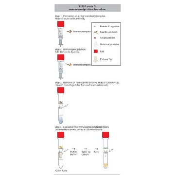 Protein G免疫沉淀试剂盒，1KIT，IP50-1KT，密理博