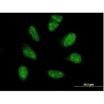 ANTI-PIM1 antibody produced in mouse，100UG，SAB1411969-100UG，Sigma