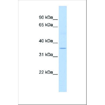 Anti-ELOVL5 antibody produced in rabbit，100UL，SAB2108121-100UL，Sigma