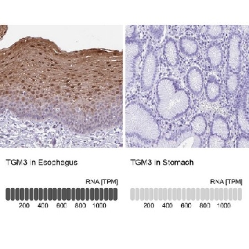 Anti-TGM3 antibody produced in rabbit，100UL，HPA004728-100UL，Sigma