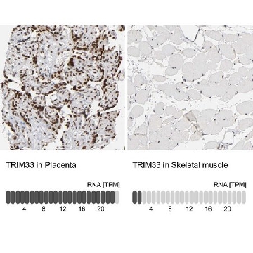 Anti-TRIM33 antibody produced in rabbit，100UL，HPA004345-100UL，Sigma