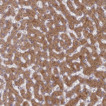 Anti-G6PC antibody produced in rabbit，100UL，HPA052324-100UL，Sigma