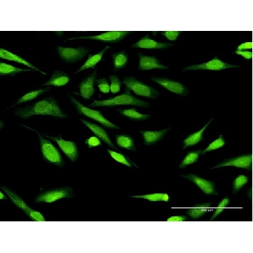 Anti-IGFBP3 antibody produced in rabbit，100UG，SAB1410698-100UG，Sigma