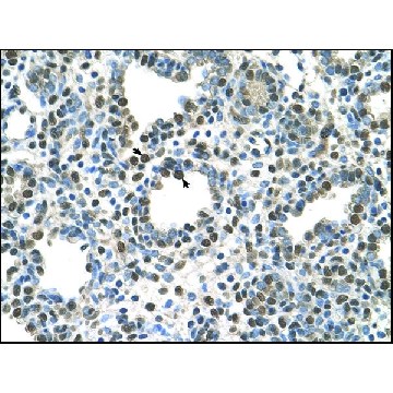 Anti-ZDHHC13 antibody produced in rabbit，100UL，AV44398-100UL，Sigma