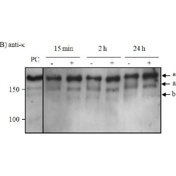 抗-人Kappa轻链（结合和游离）−过氧化物酶 山羊抗，1ML，A7164-1ML，Sigma