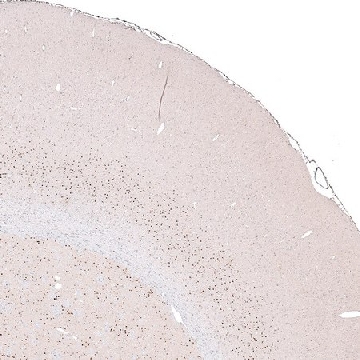Monoclonal Anti-FOXP2 antibody produced in mouse，100UL，AMAB91362-100UL，Sigma
