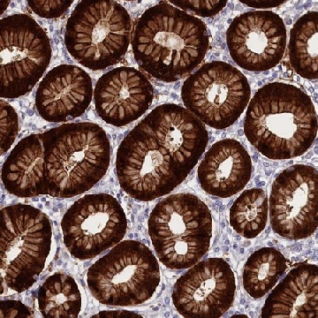 Anti-ABCC12 antibody produced in rabbit，100UL，HPA043100-100UL，Sigma
