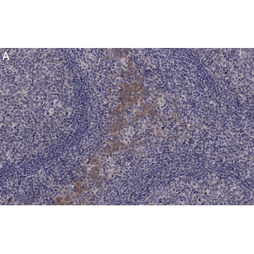 Anti-CCR2 Antibody, clone 5K5-3 ZooMAb® Rabbit Monoclonal，4X25UL，ZRB2027-4X25UL，Sigma