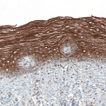 Anti-PAPD5 antibody produced in rabbit，100UL，HPA042968-100UL，Sigma