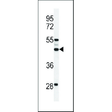 ANTI-OST ALPHA(C-TERMINAL) antibody produced in rabbit，400UL，SAB1306154-400UL，Sigma