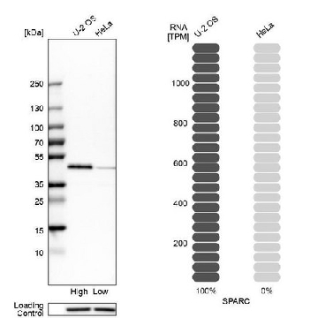Anti-SPARC antibody produced in rabbit，100UL，HPA002989-100UL，Sigma