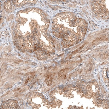 Anti-FAT1 antibody produced in rabbit，100UL，HPA023882-100UL，Sigma