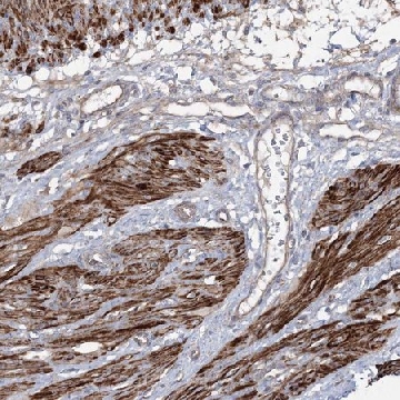 Anti-ZSWIM6 antibody produced in rabbit，100UL，HPA035938-100UL，Sigma